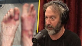 image for Tom Green Shares Gruesome Foot Injury and Third-Degree Burns After Campfire Accident