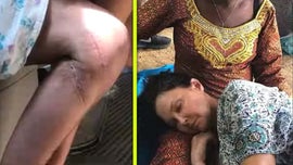 image for Ashley Judd Shows Off Scars 3 Years After Near-Death Accident in the Congo